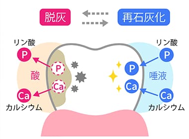 なぜ虫歯になるの？